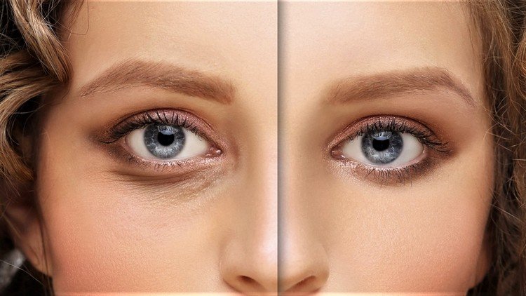 Øvelser mod hængende øjenlåg i ansigtets muskler træner før og efter