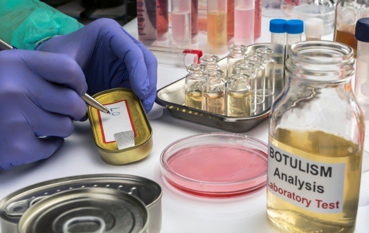 Forskeren i laboratoriet beskriver prøver fra tarmbakterier