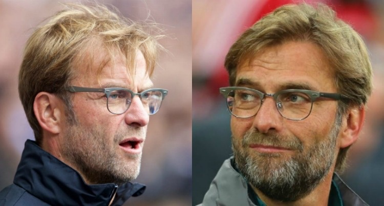 Hårtransplantation-før-efter-billede-klopp-skæg