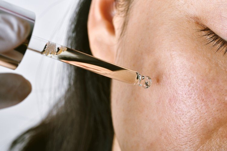eksterne måder at behandle acne på