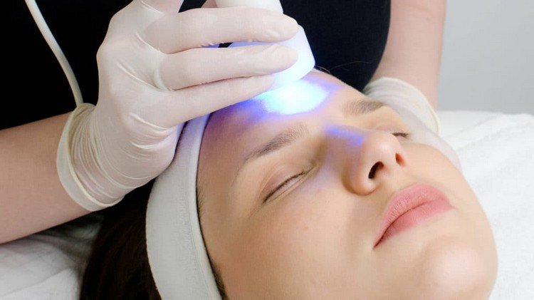 Lysterapi med blåt lys mod acne hvilke bivirkninger