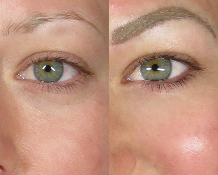 permanent-make-up-øjenbryn-sygdom-hårtab-farve-pigmentering-farve