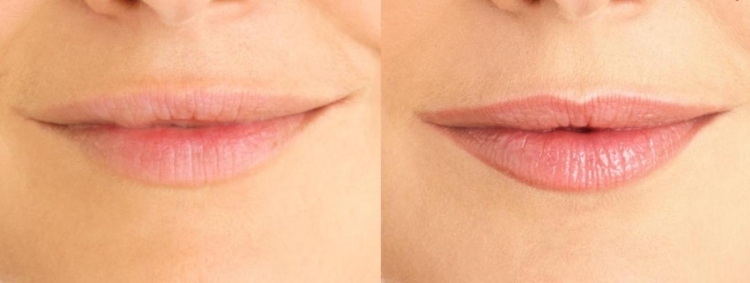 permanent-make-up-læber-før-efter-billeder-kontur