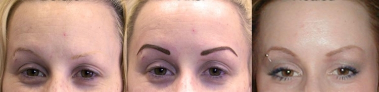 permanent-make-up-øjenbryn-dårlige-eksempler-resultater-intensiv-farve-unaturlig