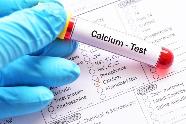 Kontroller calciumniveauet i blodserummet