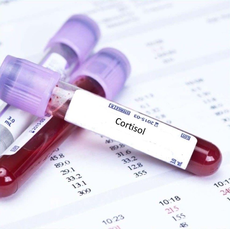 blodprøve i laboratoriet til test af cortisol