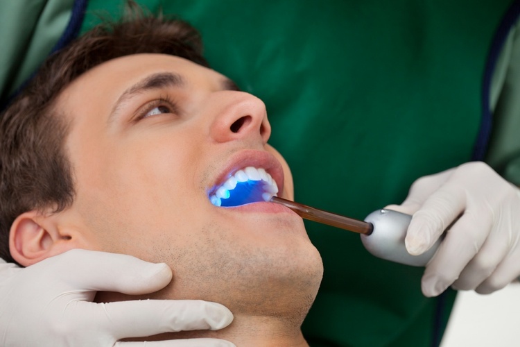 mand tandblegning behandling tandlæge kontor